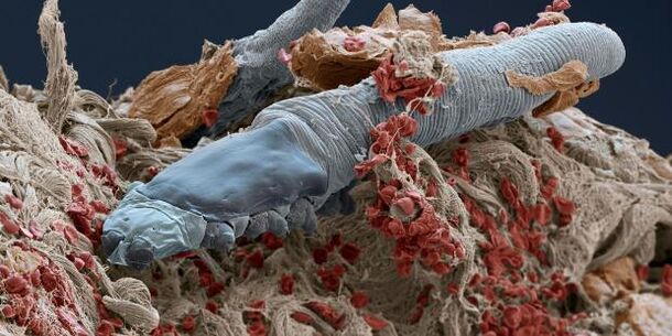 Demodex mite
