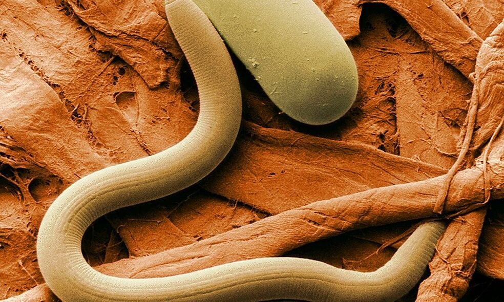 Worms are parasites of the human body