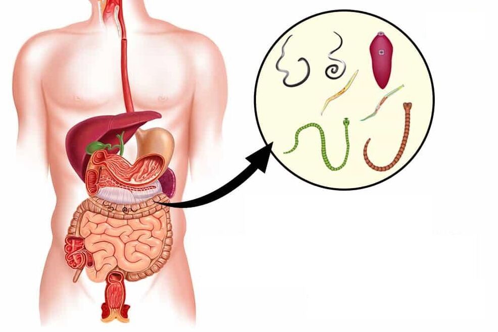 Types of human worms