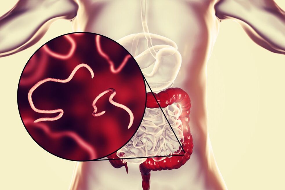 Worms in the human intestine